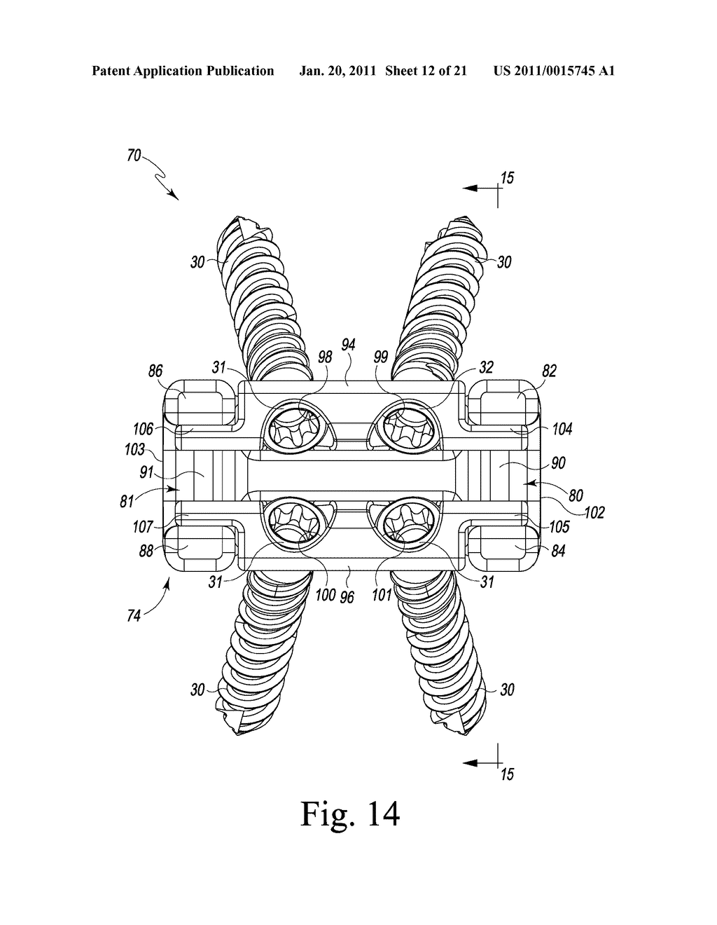 Combined Spinal Interbody and Plate Assemblies - diagram, schematic, and image 13