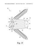 Combined Spinal Interbody and Plate Assemblies diagram and image