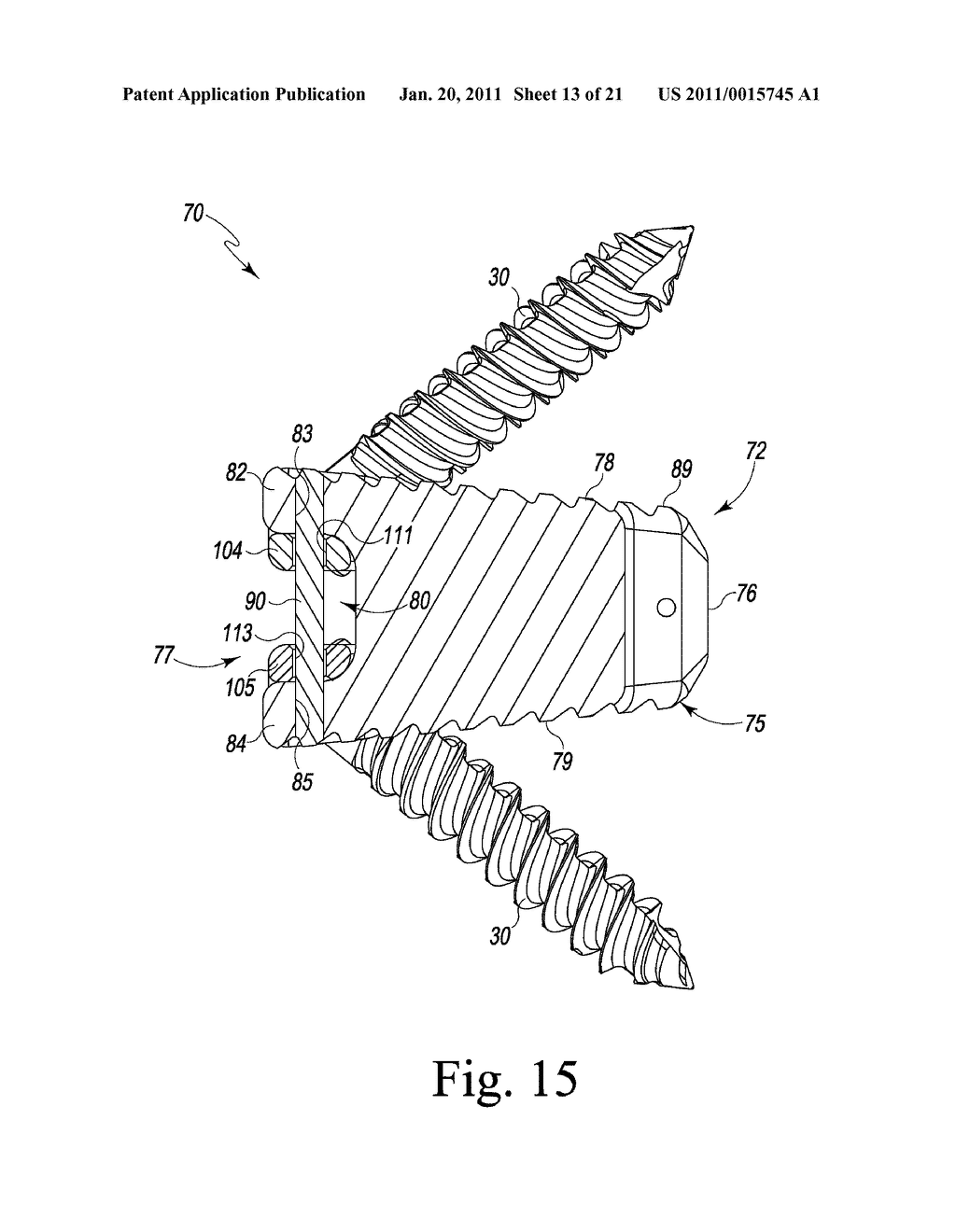 Combined Spinal Interbody and Plate Assemblies - diagram, schematic, and image 14