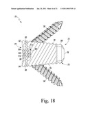 Combined Spinal Interbody and Plate Assemblies diagram and image