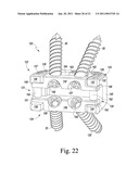 Combined Spinal Interbody and Plate Assemblies diagram and image