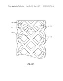 Implants with Helical Supports and Methods of Use for Spacing Vertebral Members diagram and image