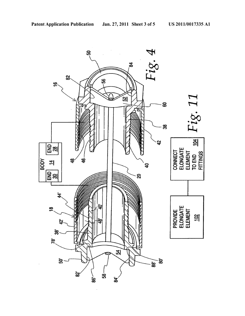 System for controlling elongation of a conduit within which flowable material is conveyed - diagram, schematic, and image 04