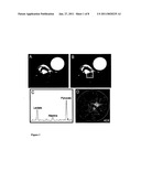 MR METHODS OF GRADING A TUMOR USING AN IMAGING MEDIUM THAT COMPRISES HYPERPOLARISED 13C-PYRUVATE diagram and image