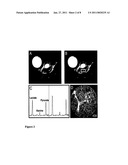 MR METHODS OF GRADING A TUMOR USING AN IMAGING MEDIUM THAT COMPRISES HYPERPOLARISED 13C-PYRUVATE diagram and image