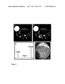 MR METHODS OF GRADING A TUMOR USING AN IMAGING MEDIUM THAT COMPRISES HYPERPOLARISED 13C-PYRUVATE diagram and image