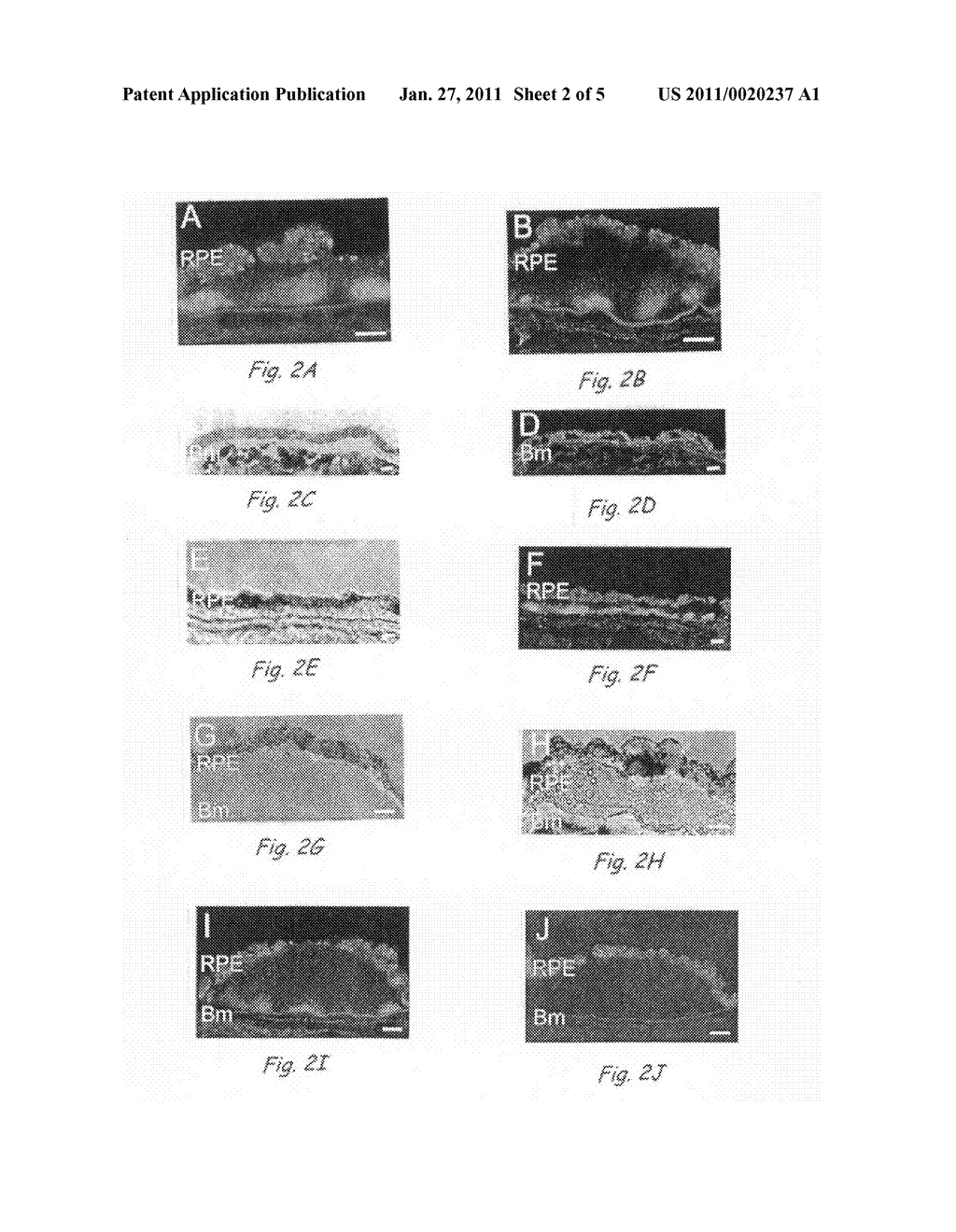 Compositions and Methods for Inhibiting Drusen Formation and for Diagnosing or Treating Drusen-Related Disorders - diagram, schematic, and image 03