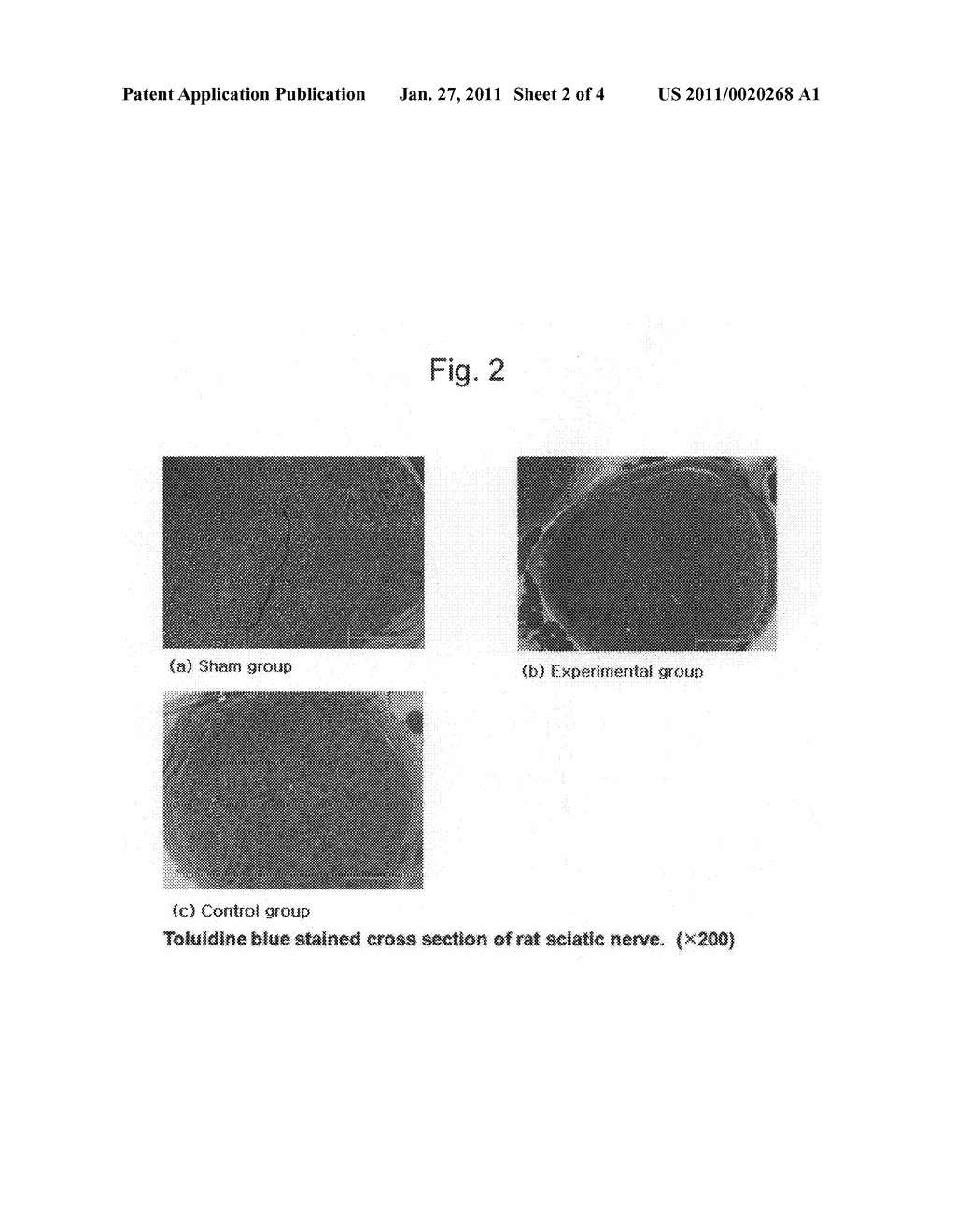 AGENT COMPRISING G-CSF FOR TREATMENT OF TRAUMATIC PERIPHERAL NERVE INJURY AND METHOD FOR TREATING TRAUMATIC PERIPHERAL NERVE INJURY WITH THE SAME - diagram, schematic, and image 03