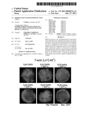 MOBILIZATION OF HEMATOPOIETIC STEM CELLS diagram and image