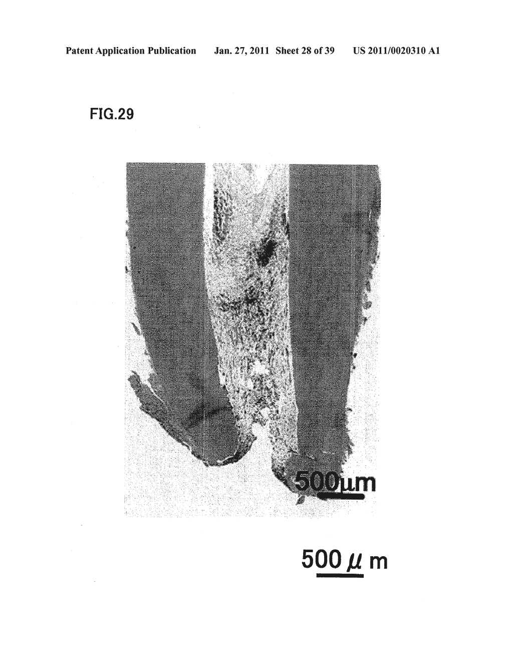 ROOT CANAL FILLER AND DENTAL TISSUE REGENERATION METHOD - diagram, schematic, and image 29