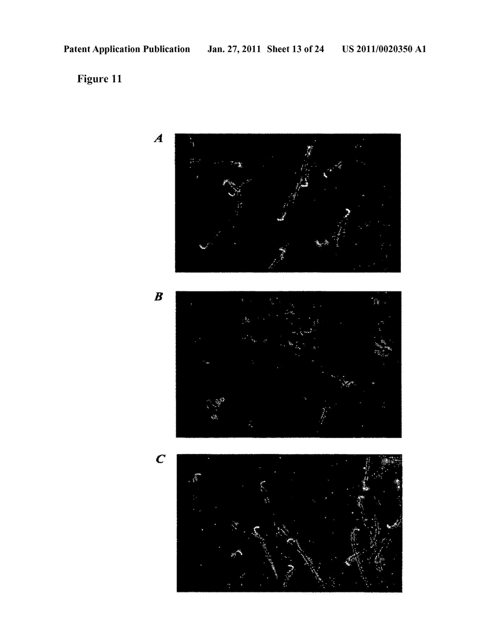 Contraceptives Based on SP22 and SP22 Antibodies - diagram, schematic, and image 14