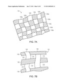 Variable Density Tissue Graft Composition and Methods of Making and Using the Same diagram and image