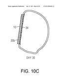 Variable Density Tissue Graft Composition and Methods of Making and Using the Same diagram and image