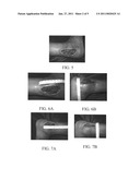 Materials and methods for wound treament diagram and image