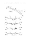 Microfluidic method and system for isolating particles from biological fluid diagram and image