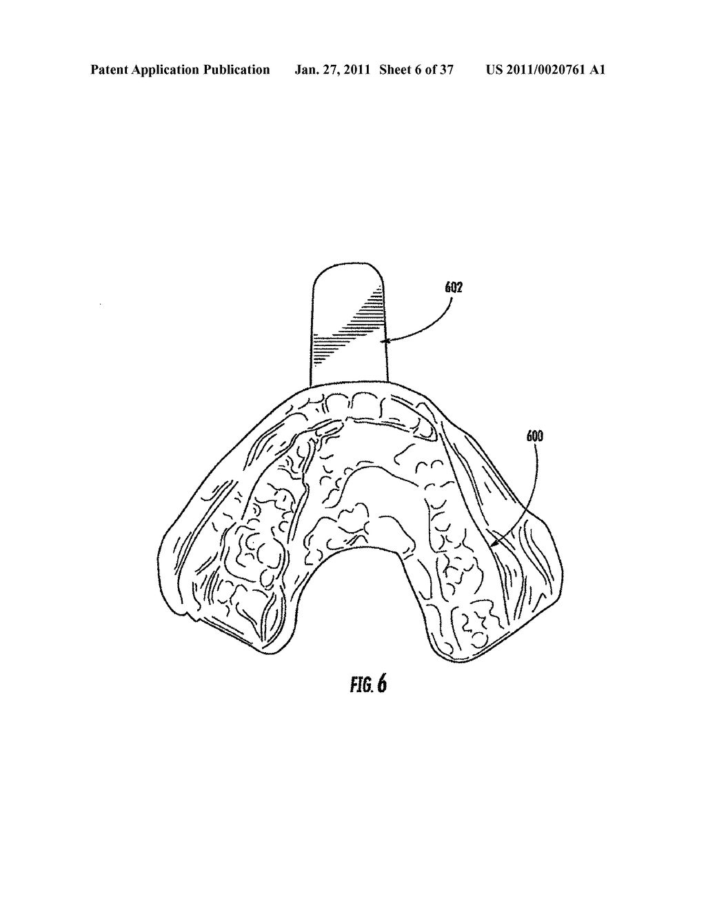 Orthodontic Repositioning Applicance - diagram, schematic, and image 07