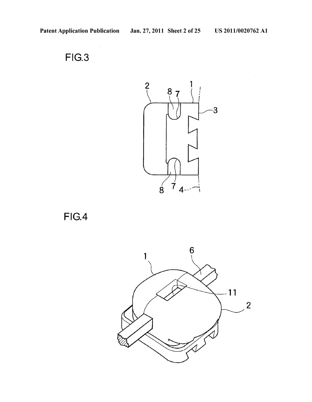 ORTHODONTIC BRACKET - diagram, schematic, and image 03