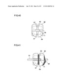 ORTHODONTIC BRACKET diagram and image