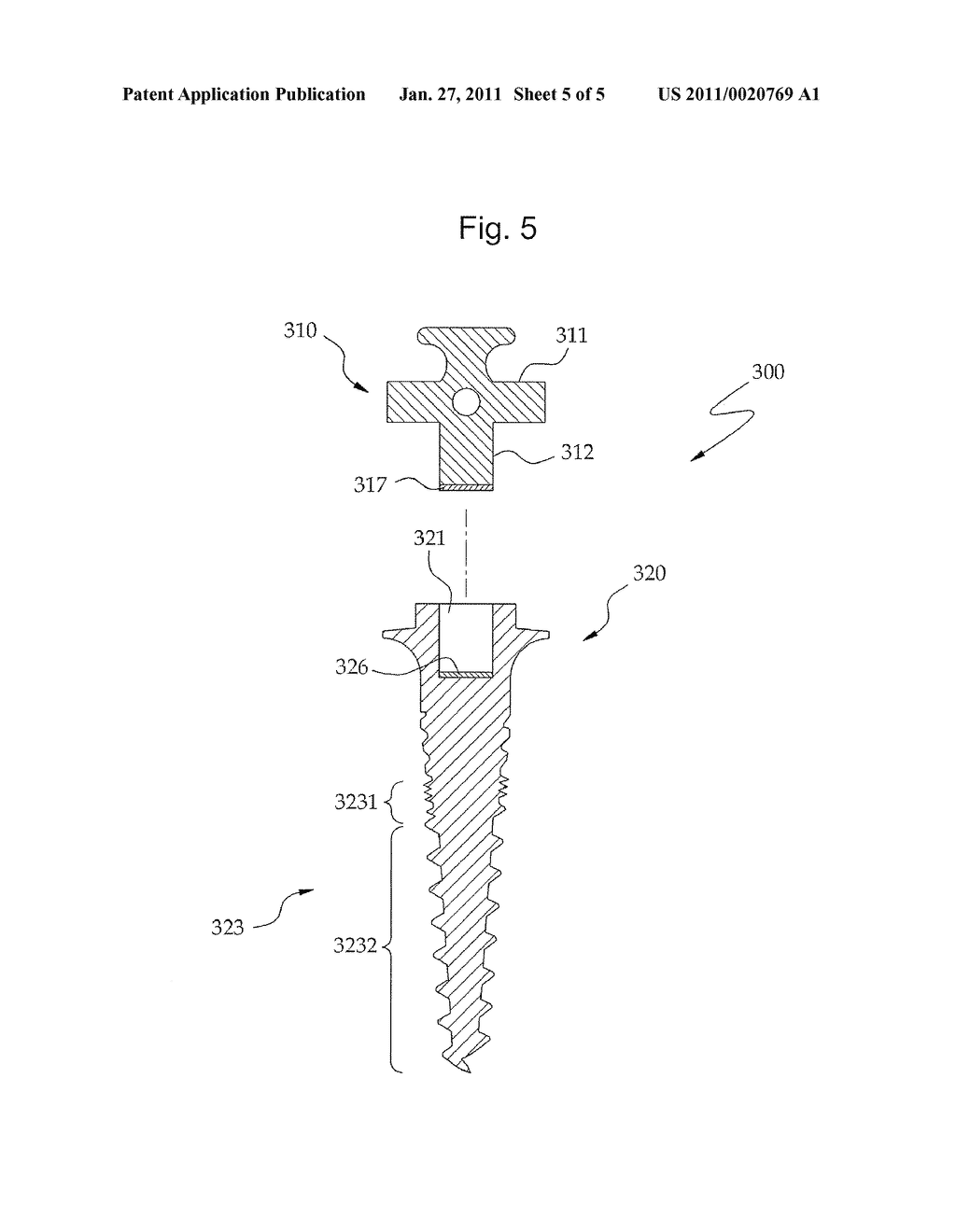 ORTHODONTIC IMPLANT SCREW ASSEMBLY - diagram, schematic, and image 06