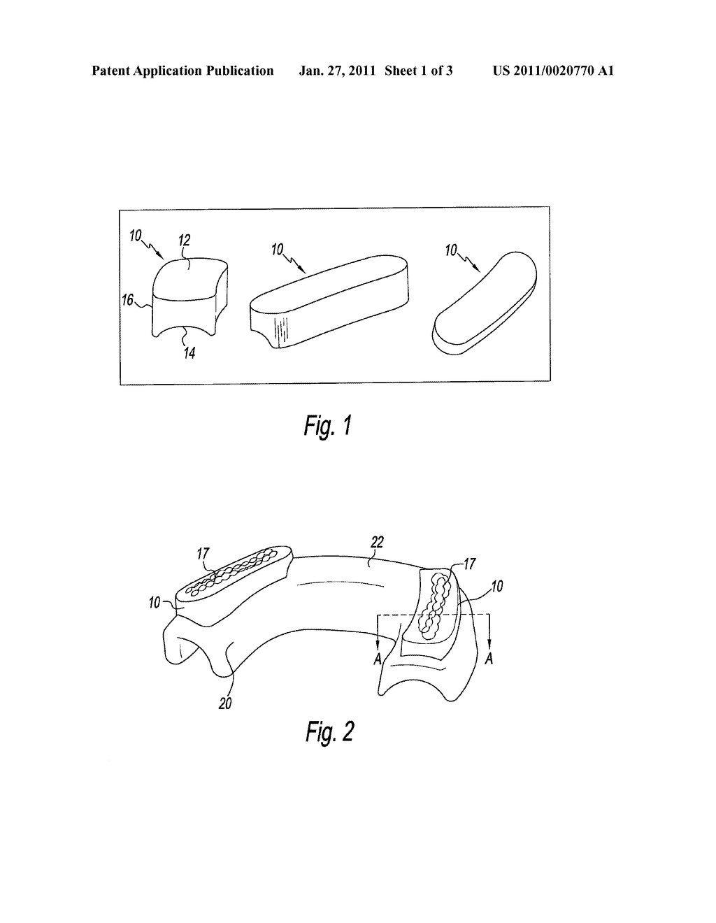 DENTAL SPLINTS AND METHOD FOR USING THE SAME - diagram, schematic, and image 02