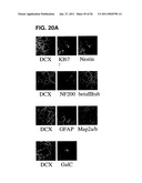 USE OF REGULATORY SEQUENCES FOR SPECIFIC, TRANSIENT EXPRESSION IN NEURONAL DETERMINED CELLS diagram and image