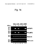 DETECTION OF UTERINE LEIOMYOSARCOMA USING LMP2 diagram and image