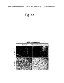 DETECTION OF UTERINE LEIOMYOSARCOMA USING LMP2 diagram and image