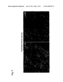 DETECTION OF UTERINE LEIOMYOSARCOMA USING LMP2 diagram and image