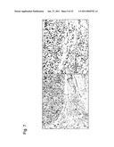 DETECTION OF UTERINE LEIOMYOSARCOMA USING LMP2 diagram and image