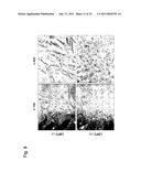 DETECTION OF UTERINE LEIOMYOSARCOMA USING LMP2 diagram and image