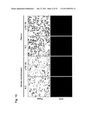 DETECTION OF UTERINE LEIOMYOSARCOMA USING LMP2 diagram and image