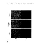 DETECTION OF UTERINE LEIOMYOSARCOMA USING LMP2 diagram and image