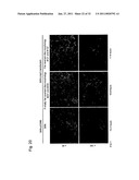 DETECTION OF UTERINE LEIOMYOSARCOMA USING LMP2 diagram and image