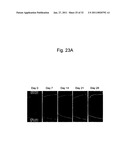 DETECTION OF UTERINE LEIOMYOSARCOMA USING LMP2 diagram and image