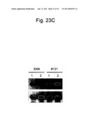 DETECTION OF UTERINE LEIOMYOSARCOMA USING LMP2 diagram and image