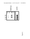 TRPC6 INVOLVED IN GLOMERULONEPHRITIS diagram and image