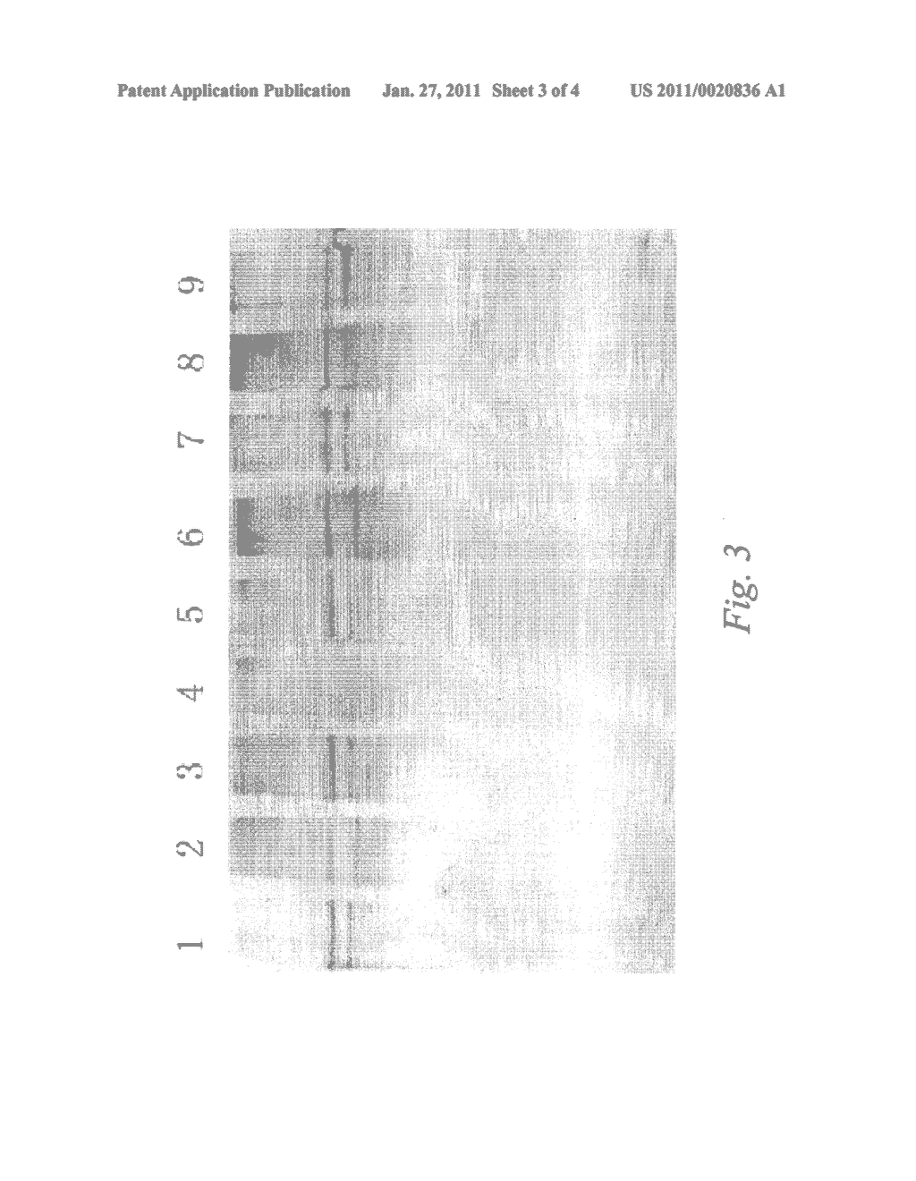 PROCESS FOR DIFFERENTIAL POLYPEPTIDES DETECTION AND USES THEREOF - diagram, schematic, and image 04