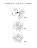 APPARATUS FOR AQUATIC EXERCISE diagram and image