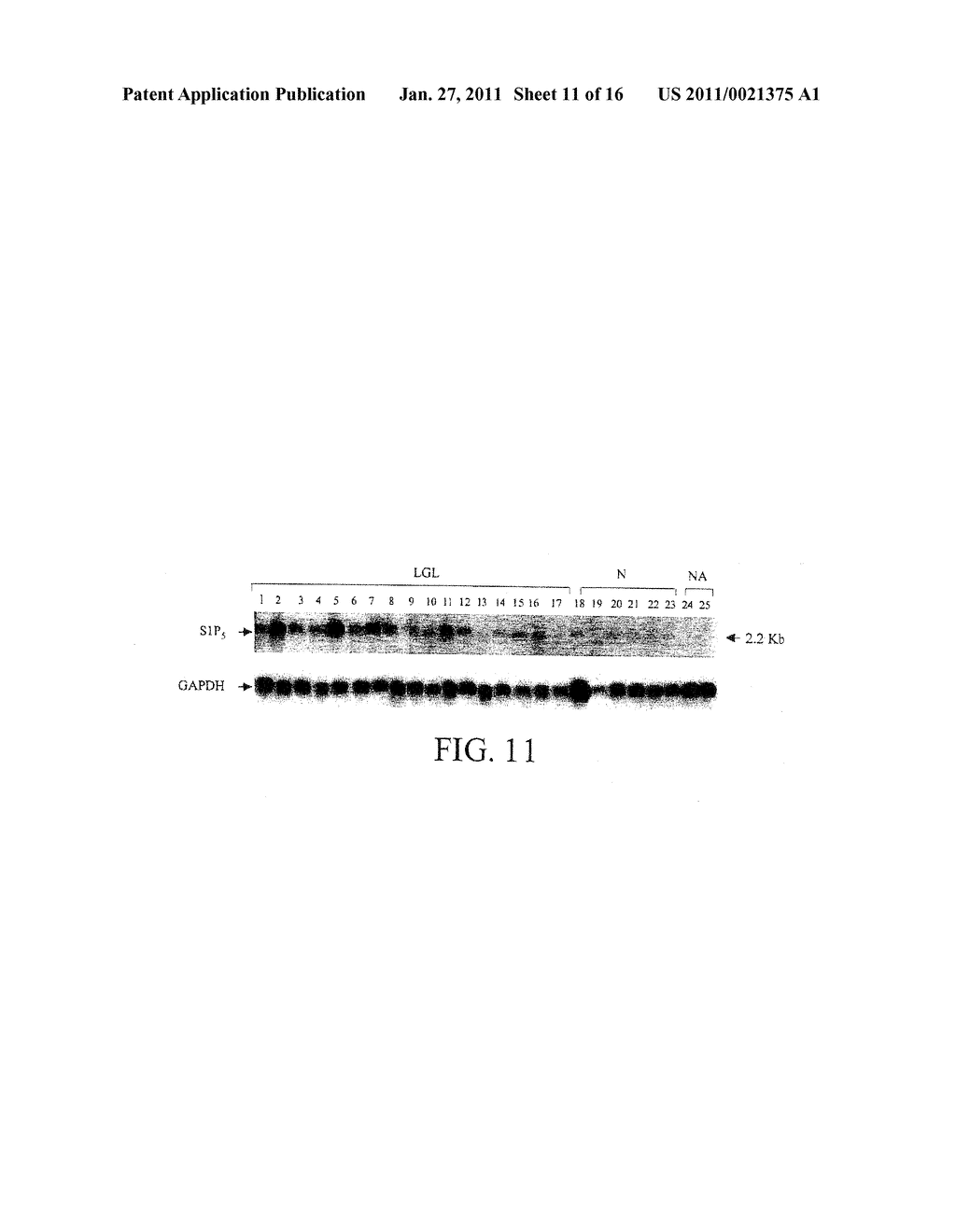 Sphingosine 1-Phosphate Receptor Gene, SPPR - diagram, schematic, and image 12