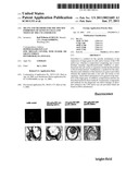 MEANS AND METHODS FOR THE SPECIFIC INHIBITION OF GENES IN CELLS AND TISSUE OF THE CNS AND/OR EYE diagram and image