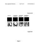 MEANS AND METHODS FOR THE SPECIFIC INHIBITION OF GENES IN CELLS AND TISSUE OF THE CNS AND/OR EYE diagram and image