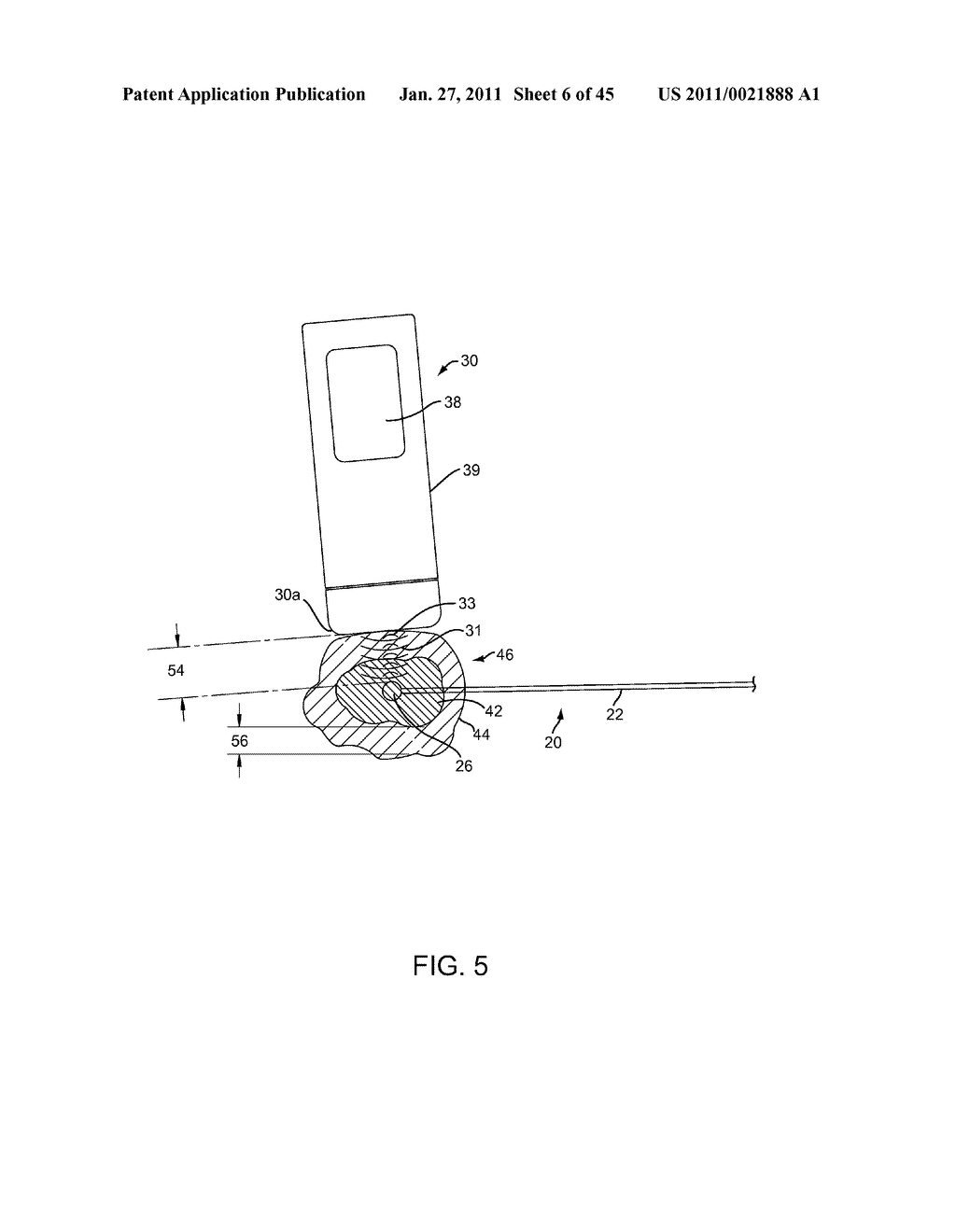 APPARATUS, SYSTEMS, AND METHODS FOR LOCALIZING MARKERS OR TISSUE STRUCTURES WITHIN A BODY - diagram, schematic, and image 07