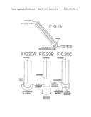 Methods and Apparatus for Intraocular Brachytherapy diagram and image