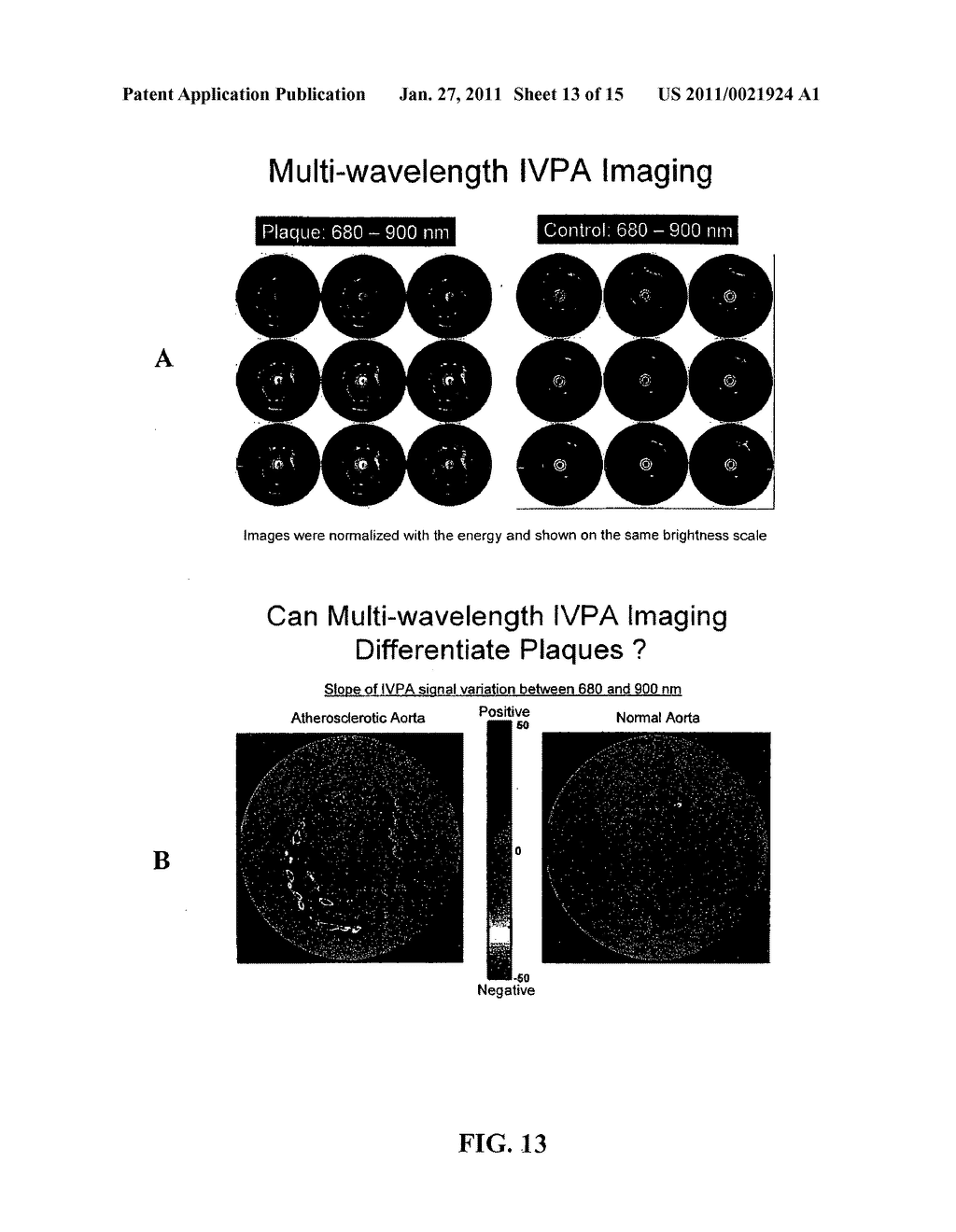 INTRAVASCULAR PHOTOACOUSTIC AND UTRASOUND ECHO IMAGING - diagram, schematic, and image 14