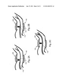 Optical Power Modulation Vital Sign Detection Method and Measurement Device diagram and image