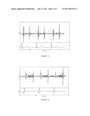 Method and Device for the Determination of Murmur Frequency Band diagram and image