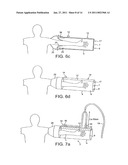 DEVICE FOR APPLYING A PULSATING PRESSURE TO A LOCAL REGION OF THE BODY AND THE APPLICATIONS THEREOF diagram and image