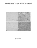 Methods And Compositions For Treating Trauma-Hemorrhage Using Estrogen And Derivatives Thereof diagram and image