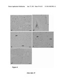 Methods And Compositions For Treating Trauma-Hemorrhage Using Estrogen And Derivatives Thereof diagram and image