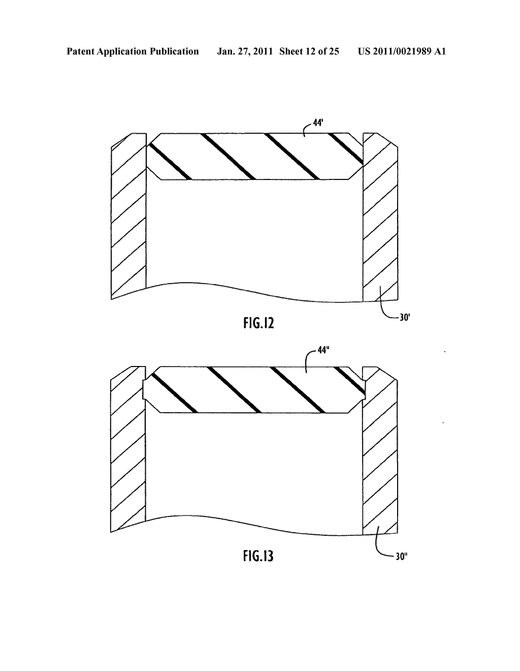 Safety medical syringe with retractable needle - diagram, schematic, and image 13